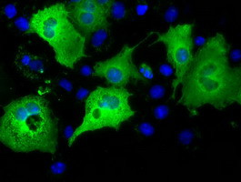 IFT57 Antibody in Immunocytochemistry (ICC/IF)