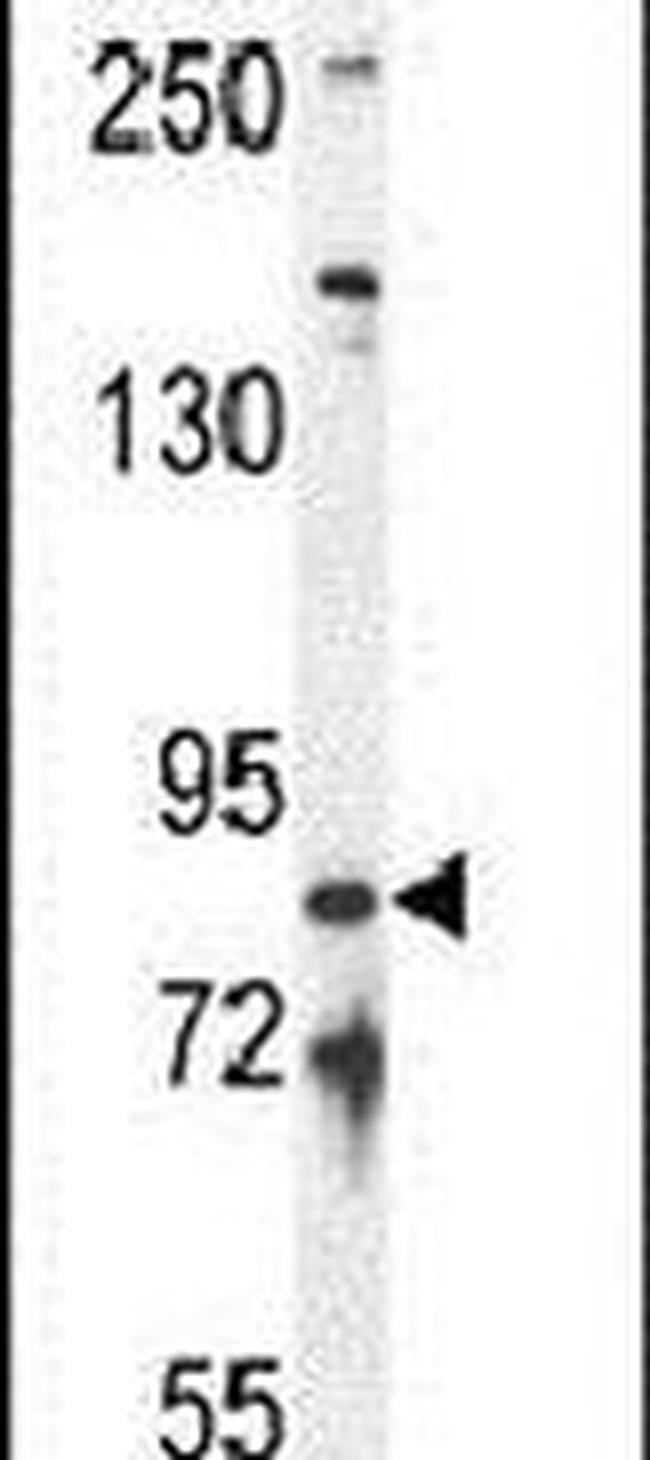 IFT81 Antibody in Western Blot (WB)