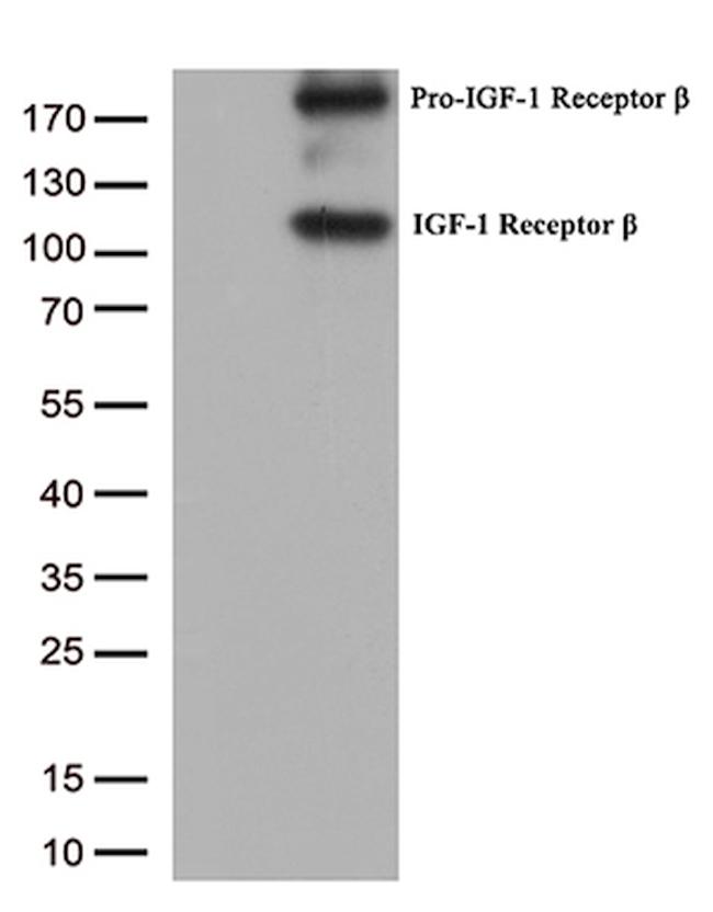 IGF1R Antibody in Western Blot (WB)