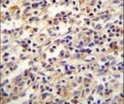 IGF2BP2 Antibody in Immunohistochemistry (IHC)