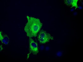 IGF2BP2 Antibody in Immunocytochemistry (ICC/IF)