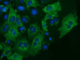 IGF2BP2 Antibody in Immunocytochemistry (ICC/IF)