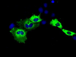 IGF2BP2 Antibody in Immunocytochemistry (ICC/IF)