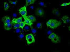 IGF2BP2 Antibody in Immunocytochemistry (ICC/IF)