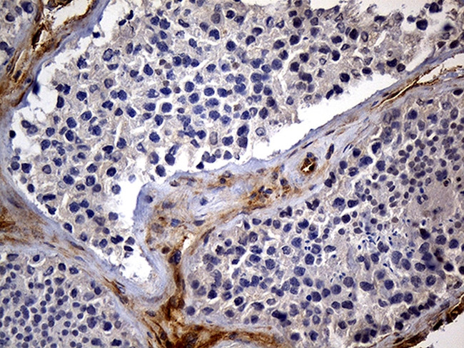 IGF2BP3 Antibody in Immunohistochemistry (Paraffin) (IHC (P))