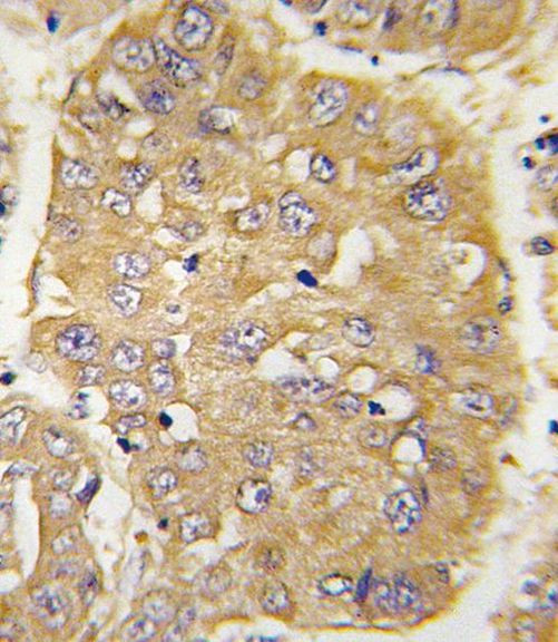 IGFBP3 Antibody in Immunohistochemistry (IHC)
