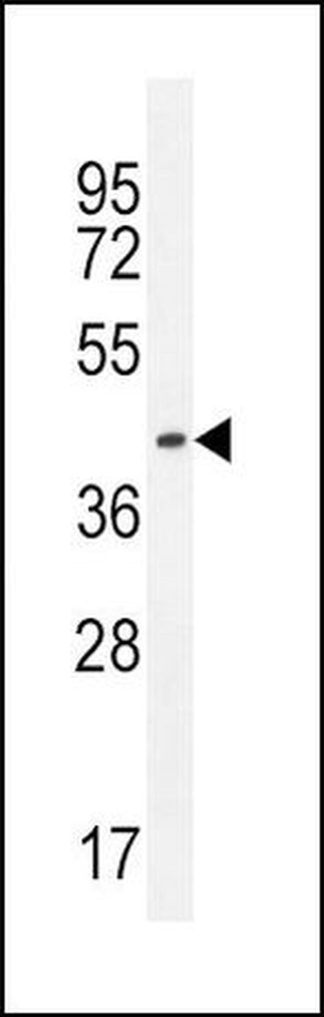 IGHG1 Antibody in Western Blot (WB)