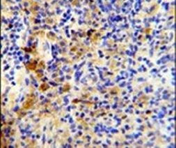 J Chain Antibody in Immunohistochemistry (IHC)