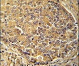 IGSF1 Antibody in Immunohistochemistry (IHC)