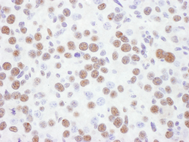 53BP1 Antibody in Immunohistochemistry (Paraffin) (IHC (P))