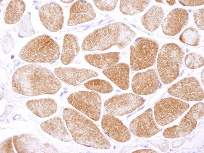 AMPK alpha 1 Antibody in Immunohistochemistry (Paraffin) (IHC (P))