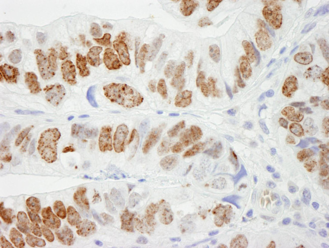 H2AX Antibody in Immunohistochemistry (Paraffin) (IHC (P))
