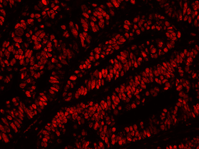 MCM2 Antibody in Immunohistochemistry (Paraffin) (IHC (P))