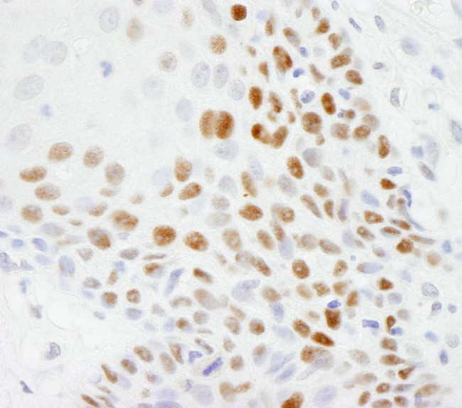 p53 Antibody in Immunohistochemistry (Paraffin) (IHC (P))