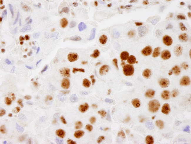 PELP1/MNAR Antibody in Immunohistochemistry (Paraffin) (IHC (P))