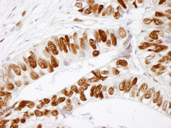 Phospho-MCM2 (Ser41) Antibody in Immunohistochemistry (Paraffin) (IHC (P))