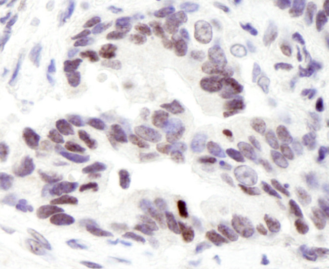 ASC2 Antibody in Immunohistochemistry (Paraffin) (IHC (P))