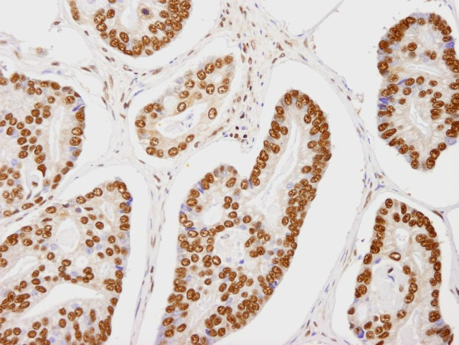 CA150 Antibody in Immunohistochemistry (Paraffin) (IHC (P))