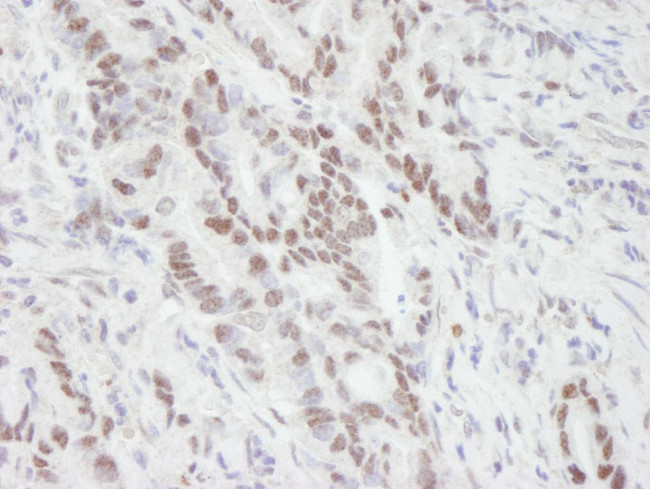 MTA1 Antibody in Immunohistochemistry (Paraffin) (IHC (P))