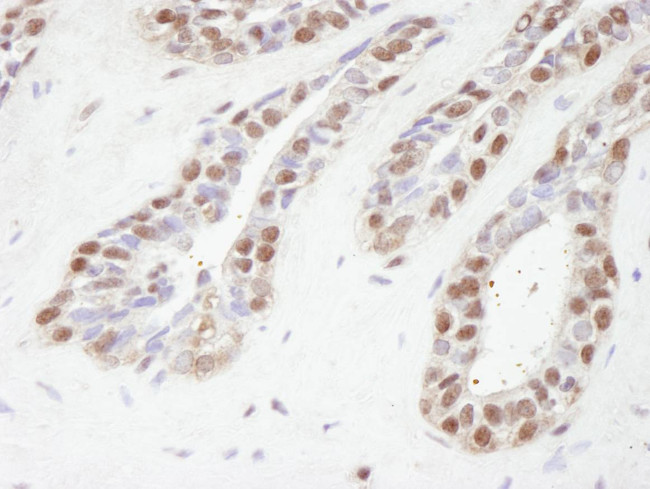 TBLR1 Antibody in Immunohistochemistry (Paraffin) (IHC (P))