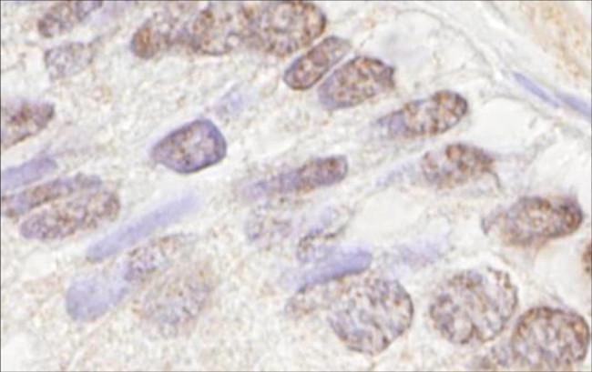 ATM Antibody in Immunohistochemistry (Paraffin) (IHC (P))