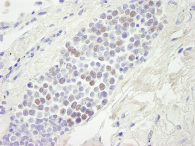 MCM4 Antibody in Immunohistochemistry (Paraffin) (IHC (P))