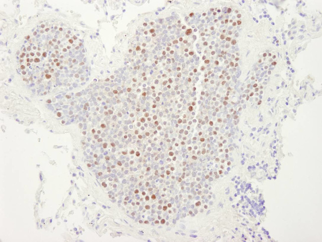 MCM4 Antibody in Immunohistochemistry (Paraffin) (IHC (P))