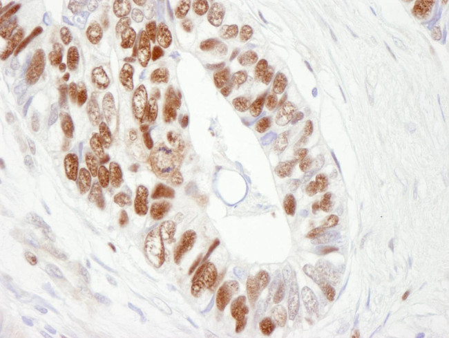 MCM6 Antibody in Immunohistochemistry (Paraffin) (IHC (P))