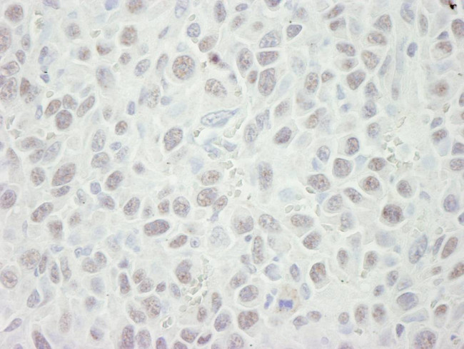MCM5 Antibody in Immunohistochemistry (Paraffin) (IHC (P))