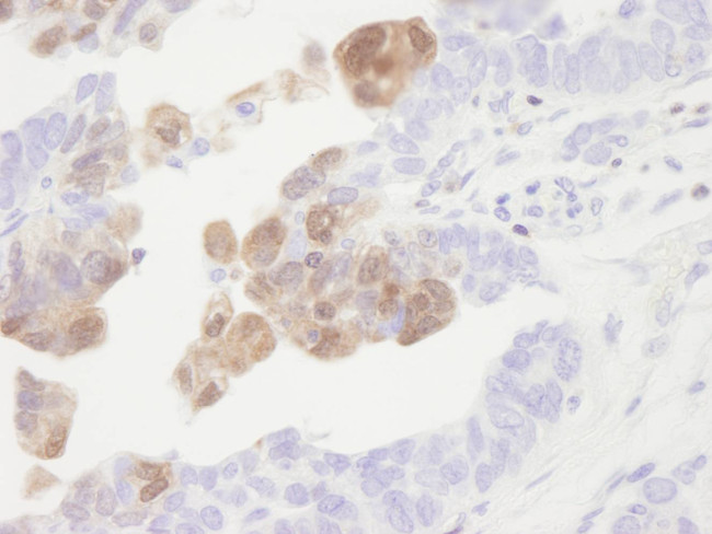 CamK4 Antibody in Immunohistochemistry (Paraffin) (IHC (P))