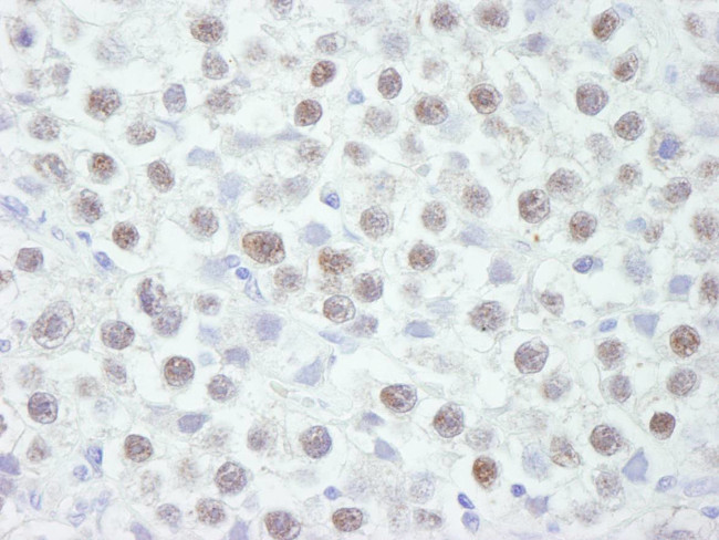 Chk2 Antibody in Immunohistochemistry (Paraffin) (IHC (P))