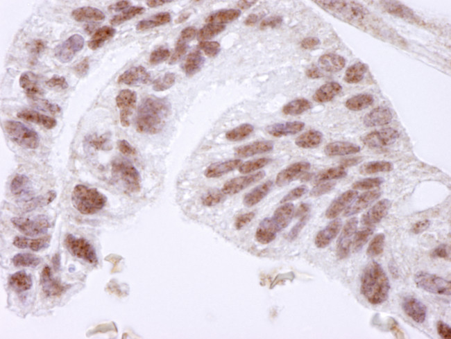CTCF Antibody in Immunohistochemistry (Paraffin) (IHC (P))