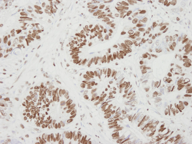 MCM6 Antibody in Immunohistochemistry (Paraffin) (IHC (P))
