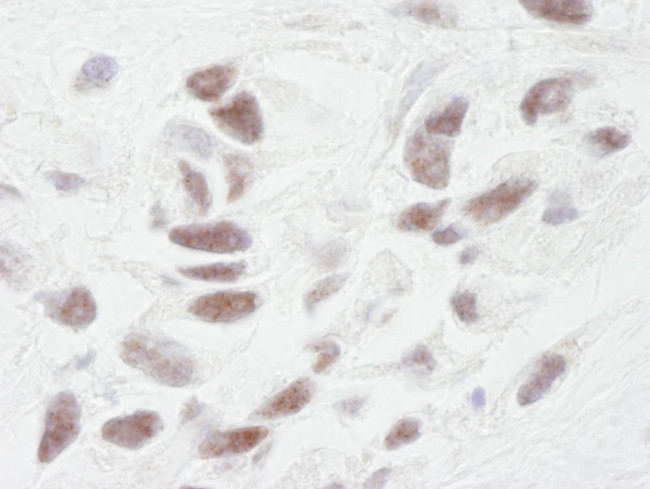 PNUTS Antibody in Immunohistochemistry (Paraffin) (IHC (P))