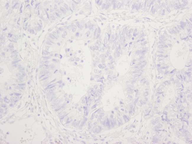 Phospho-53BP1 (Ser25) Antibody in Immunohistochemistry (Paraffin) (IHC (P))