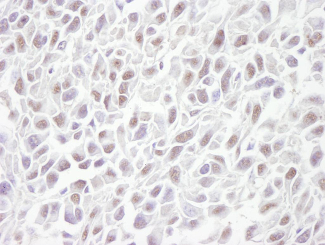 SMC3 Antibody in Immunohistochemistry (Paraffin) (IHC (P))