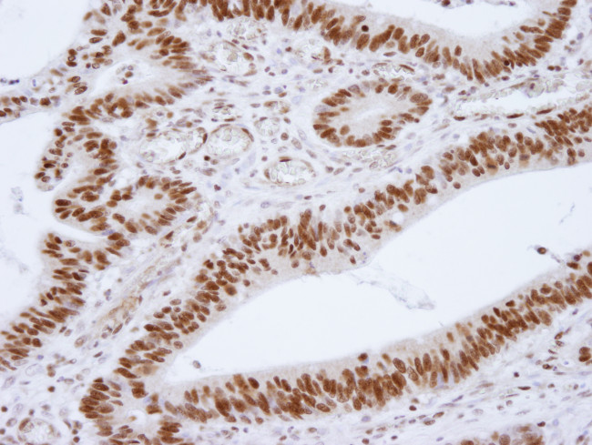 HDAC1 Antibody in Immunohistochemistry (Paraffin) (IHC (P))