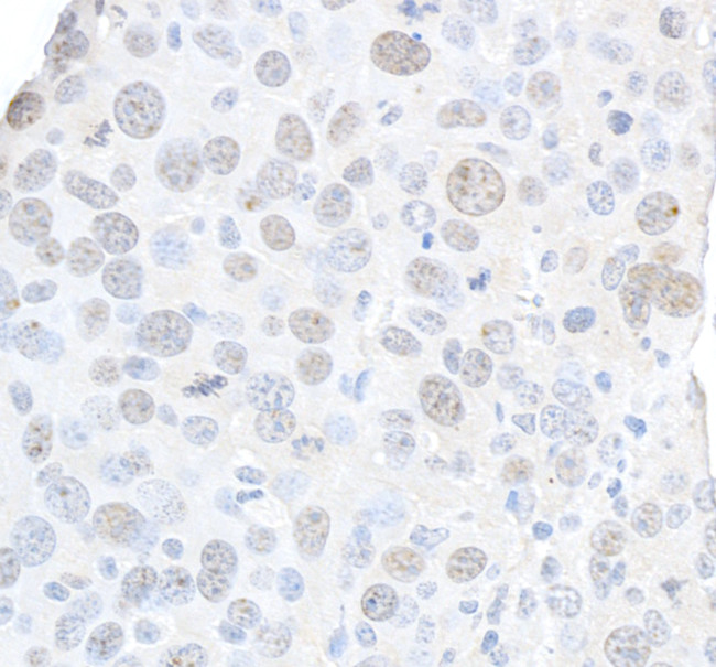 Phospho-gamma-H2AX (Ser139) Antibody in Immunohistochemistry (Paraffin) (IHC (P))