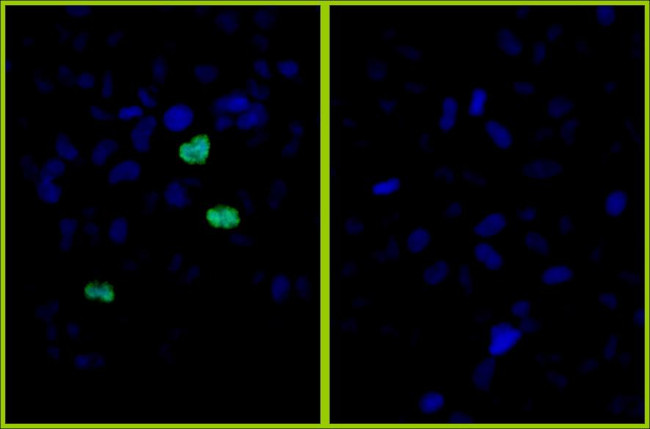 Phospho-Histone H3 (Ser10) Antibody in Immunocytochemistry (ICC/IF)