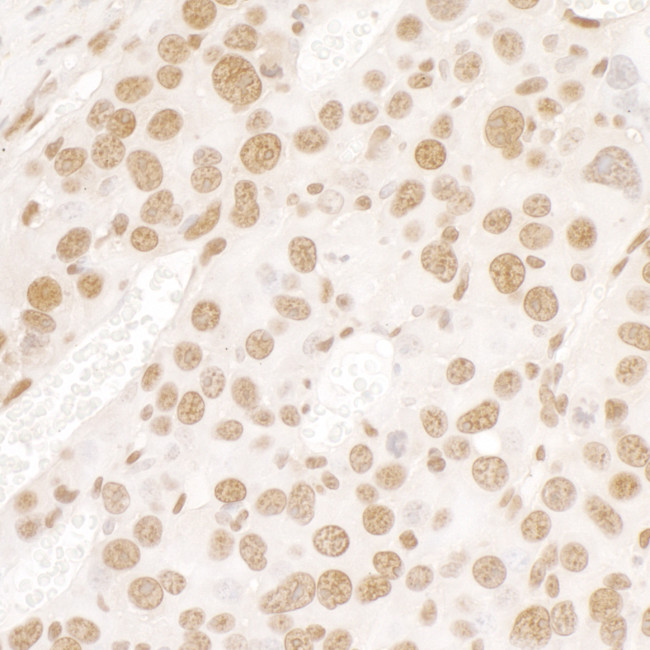 FUS Antibody in Immunohistochemistry (Paraffin) (IHC (P))