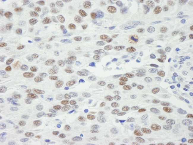 MDC1 Antibody in Immunohistochemistry (Paraffin) (IHC (P))