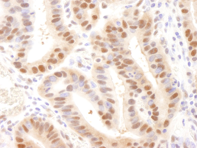 Rad6 Antibody in Immunohistochemistry (Paraffin) (IHC (P))