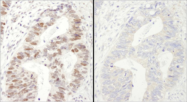 Phospho-MCM2 (Ser40, Ser41) Antibody in Immunohistochemistry (Paraffin) (IHC (P))