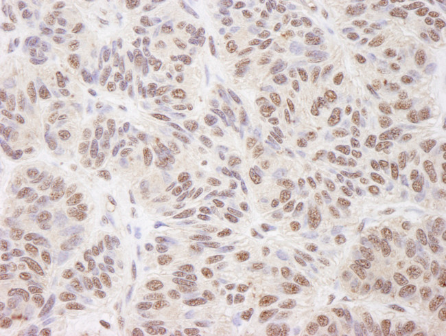 BTF Antibody in Immunohistochemistry (Paraffin) (IHC (P))