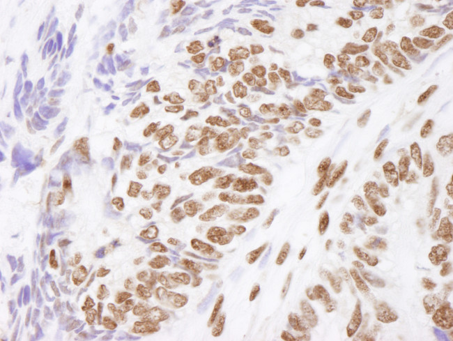 Matrin 3 Antibody in Immunohistochemistry (Paraffin) (IHC (P))