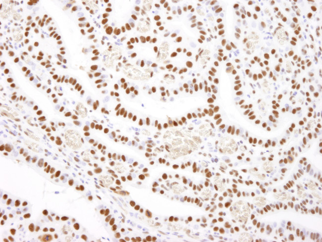 Nucleolin/NCL Antibody in Immunohistochemistry (Paraffin) (IHC (P))