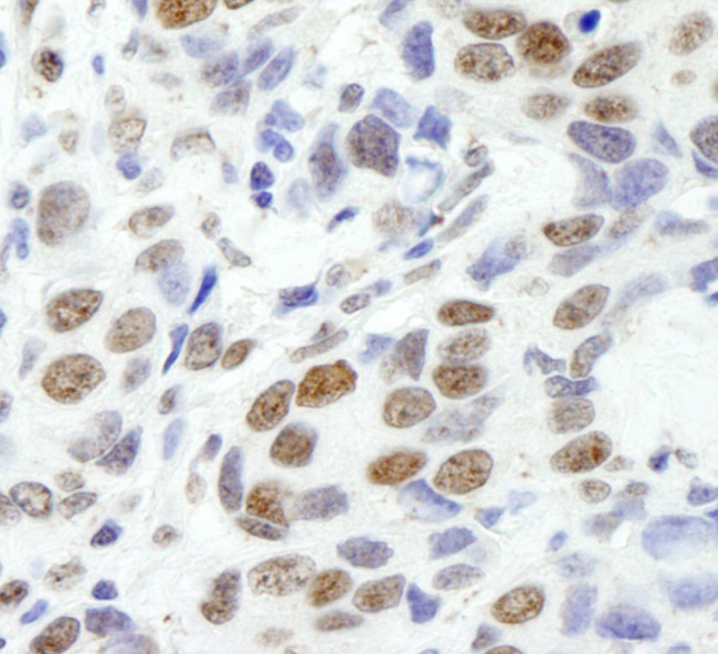 EWS Antibody in Immunohistochemistry (Paraffin) (IHC (P))