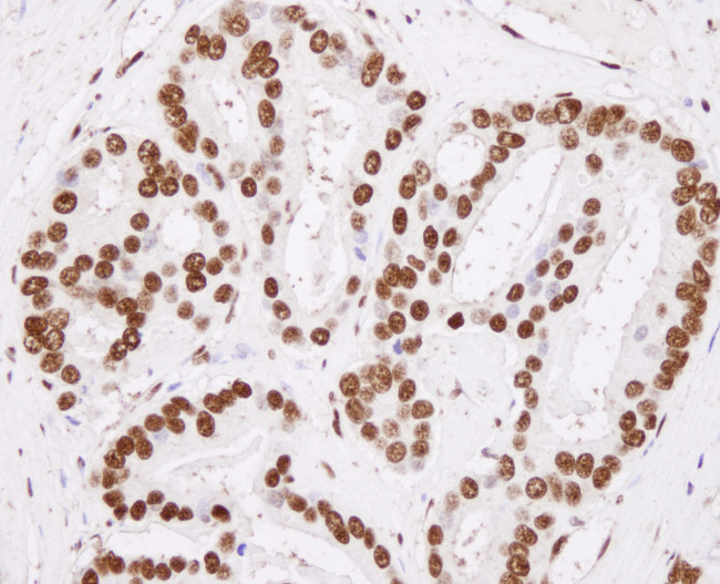 hnRNP-H Antibody in Immunohistochemistry (Paraffin) (IHC (P))