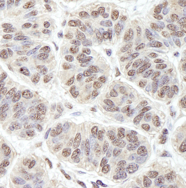 PRKRIR Antibody in Immunohistochemistry (Paraffin) (IHC (P))