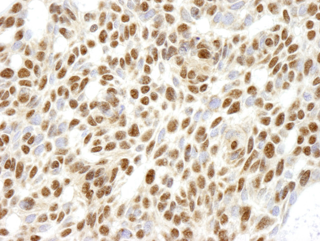RPL26 Antibody in Immunohistochemistry (Paraffin) (IHC (P))